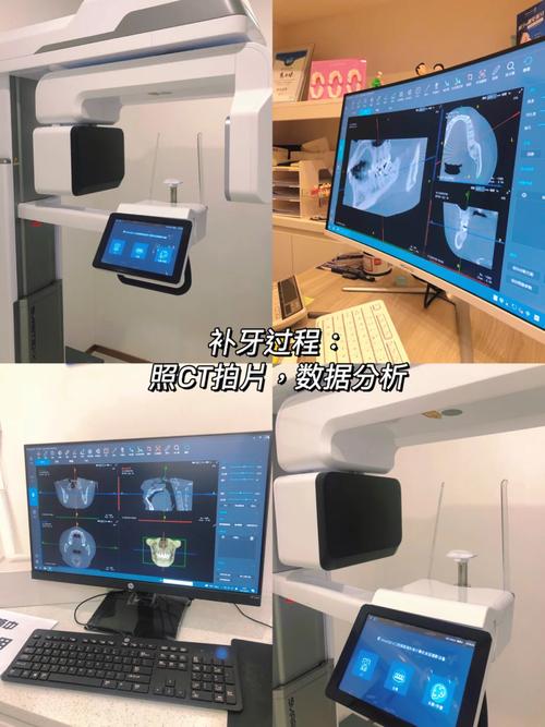 口腔健康與專業醫療服務 為何口腔護理和咨詢缺一不可